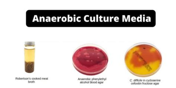Are coliforms aerobic or anaerobic?