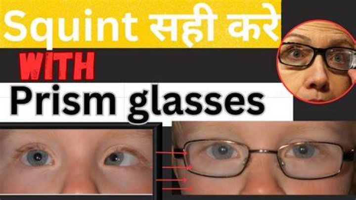 Will glasses correct squint?